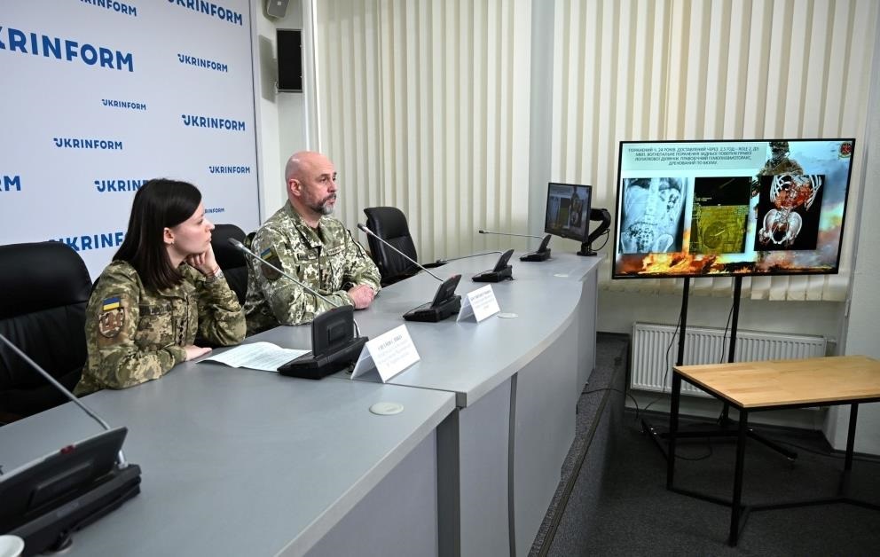 Новини України - Вже не кулі: головний хірург ЗСУ розповів, що найбільше травмує бійців