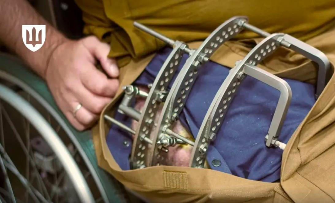 Новини України - Військові почали отримувати Пакунок пораненого